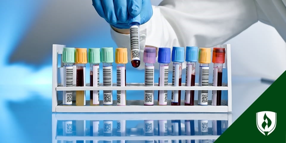medical lab technician putting blood samples in tray